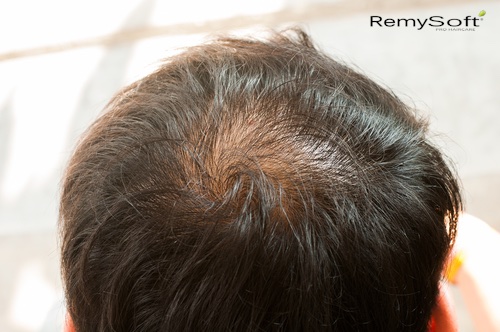 products to regrow hair naturally